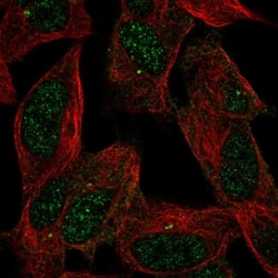 PAP2 Antibody, Novus Biologicals 25 &mu;L; Unlabeled:Antibodies, Polyclonal