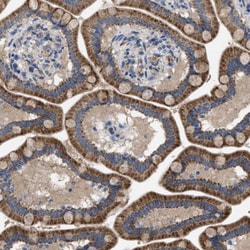 PAP2 Antibody, Novus Biologicals 25 &mu;L; Unlabeled:Antibodies, Polyclonal