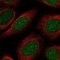 PAPOLB Rabbit anti-Human, Polyclonal, Novus Biologicals:Antibodies:Primary
