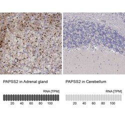 PAPSS2 Rabbit anti-Human, Polyclonal, Novus Biologicals:Antibodies:Primary
