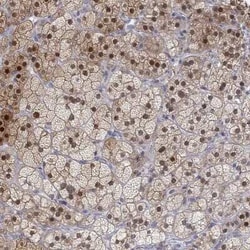 PAPSS2 Rabbit anti-Human, Polyclonal, Novus Biologicals:Antibodies:Primary