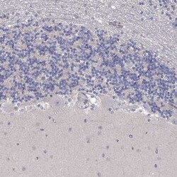 PAPSS2 Rabbit anti-Human, Polyclonal, Novus Biologicals:Antibodies:Primary