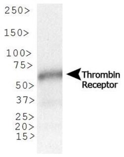 PAR1/Thrombin Receptor Antibody (N2-11), Novus Biologicals:Antibodies:Primary