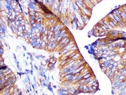 PAR2 Rabbit anti-Human, Mouse, Rat, Clone: 9X8E6, Novus Biologicals:Antibodies:Primary