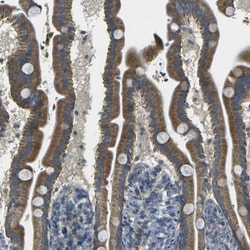 PARD6B Antibody, Novus Biologicals:Antibodies:Primary Antibodies