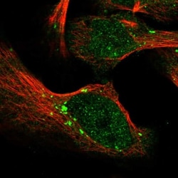 PARG Antibody, Novus Biologicals 25 &mu;L; Unlabeled:Antibodies, Polyclonal