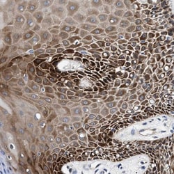 PARG Antibody, Novus Biologicals 25 &mu;L; Unlabeled:Antibodies, Polyclonal