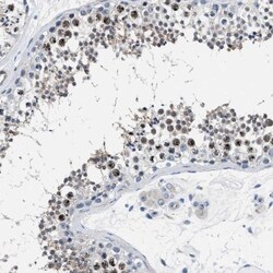 PARG Antibody, Novus Biologicals 25 &mu;L; Unlabeled:Antibodies, Polyclonal