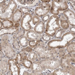 PARG1 Antibody, Novus Biologicals:Antibodies:Primary Antibodies
