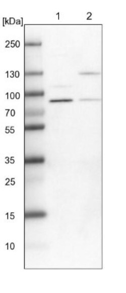 PARN Antibody, Novus Biologicals 0.1mL; Unlabeled:Antikörper