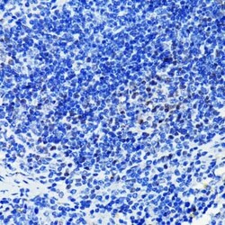 PARP Rabbit anti-Human, Mouse, Rat, Clone: 2O6H4, Novus Biologicals 20 &mu;g | Buy Online | Novus Biologicals | Fisher Scientific