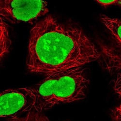 PARP Antibody, Novus Biologicals 0.1mL; Unlabeled:Antibodies, Polyclonal