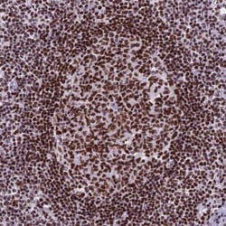 PARP Antibody, Novus Biologicals 0.1mL; Unlabeled:Antibodies, Polyclonal