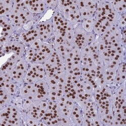 PARP Antibody, Novus Biologicals 0.1mL; Unlabeled:Antibodies, Polyclonal