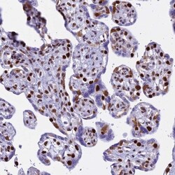 PARP Antibody, Novus Biologicals 0.1mL; Unlabeled:Antibodies, Polyclonal
