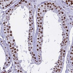PARP Antibody, Novus Biologicals 0.1mL; Unlabeled:Antibodies, Polyclonal