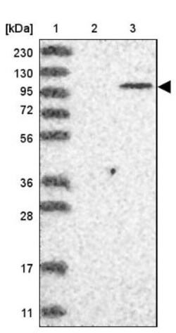 PARP10 Antibody, Novus Biologicals 0.1mL; Unlabeled:Antibodies, Polyclonal
