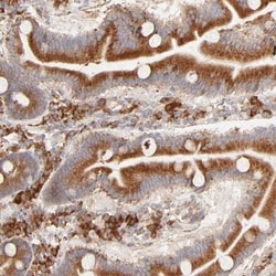 PARP12 Antibody, Novus Biologicals:Antibodies:Primary Antibodies
