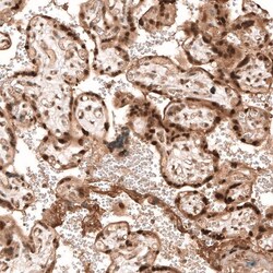 PARP14 Antibody, Novus Biologicals 0.1mL; Unlabeled:Antibodies, Polyclonal