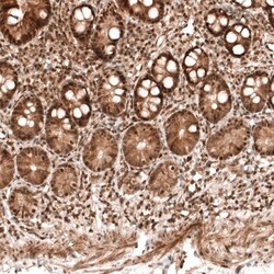PARP14 Antibody, Novus Biologicals 0.1mL; Unlabeled:Antibodies, Polyclonal