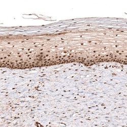 PARP14 Antibody, Novus Biologicals 0.1mL; Unlabeled:Antibodies, Polyclonal