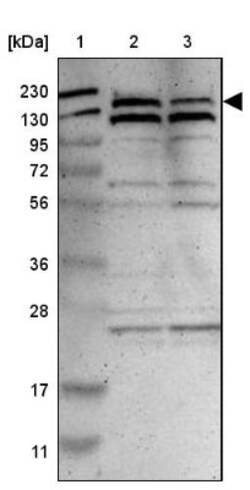 PARP14 Antibody, Novus Biologicals 0.1mL; Unlabeled:Antibodies, Polyclonal
