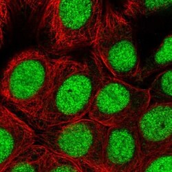 PARP2 Antibody, Novus Biologicals 0.1mL; Unlabeled:Antibodies, Polyclonal