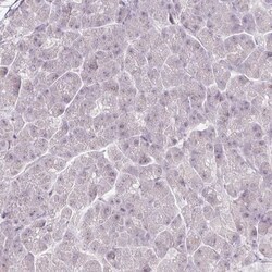 PARP2 Antibody, Novus Biologicals 0.1mL; Unlabeled:Antibodies, Polyclonal