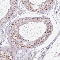 PARP2 Antibody, Novus Biologicals 0.1mL; Unlabeled:Antibodies, Polyclonal