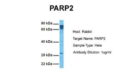 PARP2 Antibody, Novus Biologicals:Antibodies:Primary Antibodies