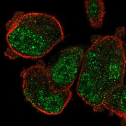 PASD1 Antibody, Novus Biologicals 0.1mL; Unlabeled:Antibodies, Polyclonal