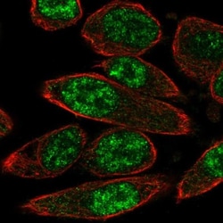 PASD1 Antibody, Novus Biologicals:Antibodies:Primary Antibodies