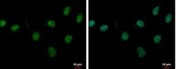PASD1 Antibody, Novus Biologicals 0.1mL; Unlabeled:Antibodies, Polyclonal