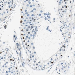 PASD1 Antibody, Novus Biologicals 0.1mL; Unlabeled:Antibodies, Polyclonal