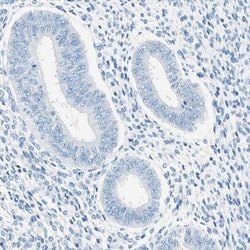 PASD1 Antibody, Novus Biologicals 0.1mL; Unlabeled:Antibodies, Polyclonal