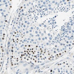 PASD1 Antibody, Novus Biologicals 0.1mL; Unlabeled:Antibodies, Polyclonal
