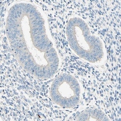 PASD1 Antibody, Novus Biologicals:Antibodies:Primary Antibodies