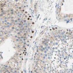 PASD1 Antibody, Novus Biologicals:Antibodies:Primary Antibodies
