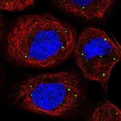 PATL1 Antibody, Novus Biologicals:Antibodies:Primary Antibodies