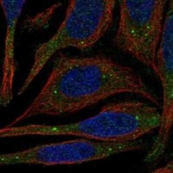 PATL1 Rabbit anti-Human, Polyclonal, Novus Biologicals:Antibodies:Primary