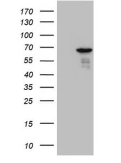 PATZ Antibody (OTI8D6), Novus Biologicals 0.1mL; Unlabeled:Antibodies,