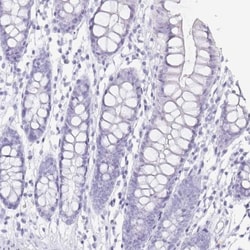 PAUF/ZG16B Antibody, Novus Biologicals 0.1mL; Unlabeled:Antibodies, Polyclonal