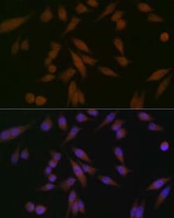 PAWR / PAR4 Rabbit anti-Human, Mouse, Clone: 10Q2G9, Novus Biologicals:Antibodies:Primary