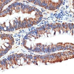 PAWR / PAR4 Rabbit anti-Human, Mouse, Clone: 10Q2G9, Novus Biologicals:Antibodies:Primary