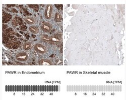 PAWR/ PAR4 Antibody, Novus Biologicals:Antibodies:Primary Antibodies