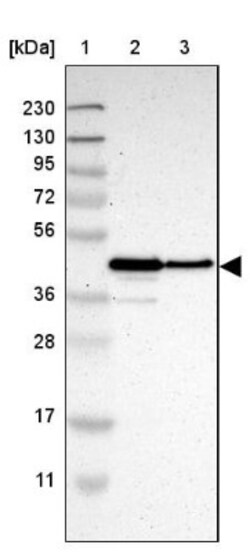PAWR/ PAR4 Antibody, Novus Biologicals:Antibodies:Primary Antibodies