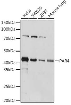PAWR / PAR4 Rabbit anti-Human, Mouse, Clone: 10Q2G9, Novus Biologicals:Antibodies:Primary