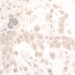 PBEF/Visfatin/NAMPT Antibody, Novus Biologicals 0.1mg; Unlabeled:Antikroppar