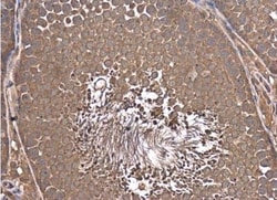 anti-PBEF/Visfatin/NAMPT, Polyclonal, Novus Biologicals 0.1 mL | Buy Online | Novus Biologicals | Fisher Scientific