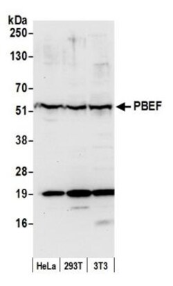 PBEF/Visfatin/NAMPT Antibody, Novus Biologicals 0.1mg; Unlabeled:Antikroppar